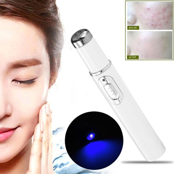 SKIN SPOTS REMOVAL LASER PEN